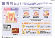 患者さん指導用ボード