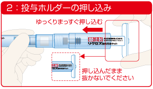 2:投与ホルダーの押し込み